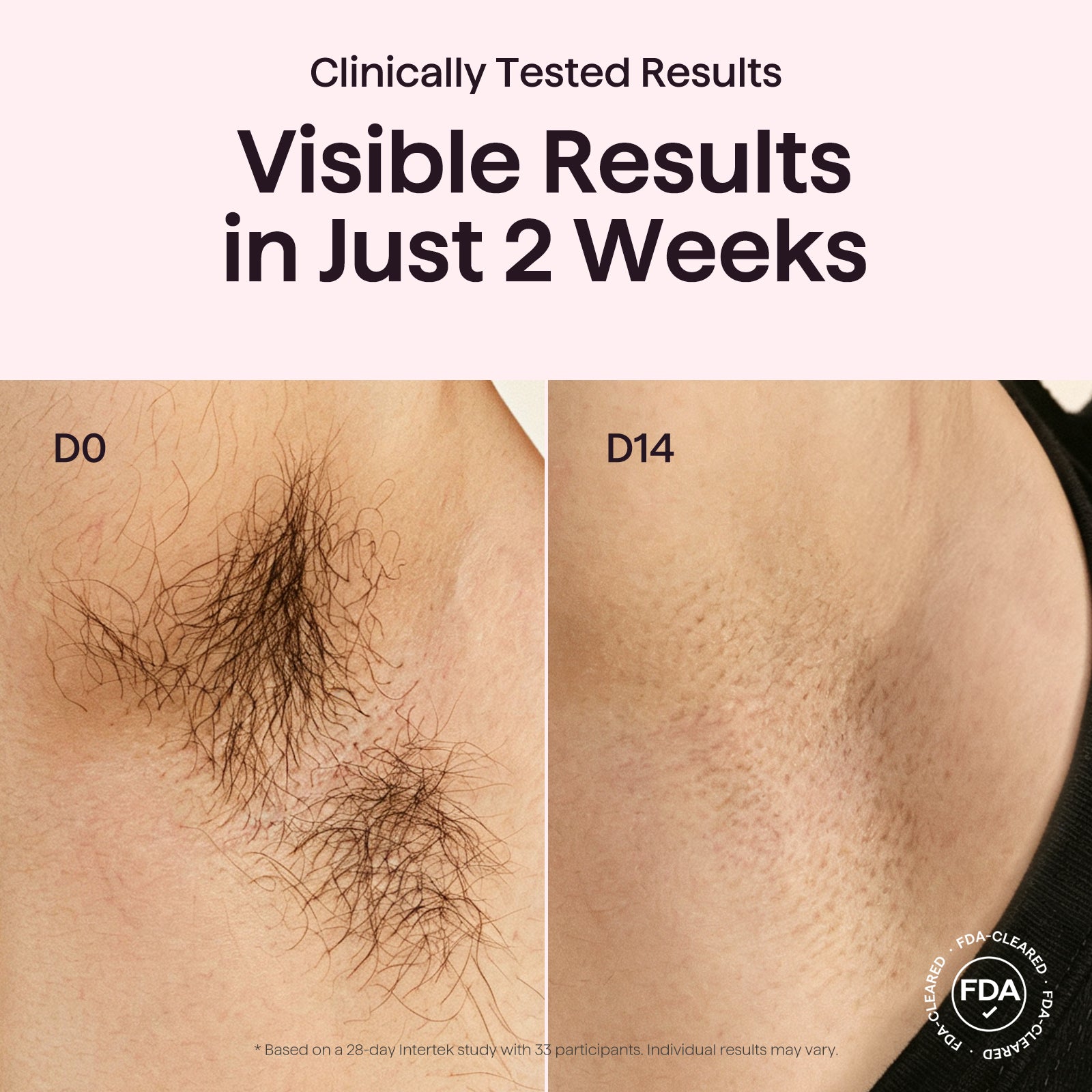 Bare It - Image 21
